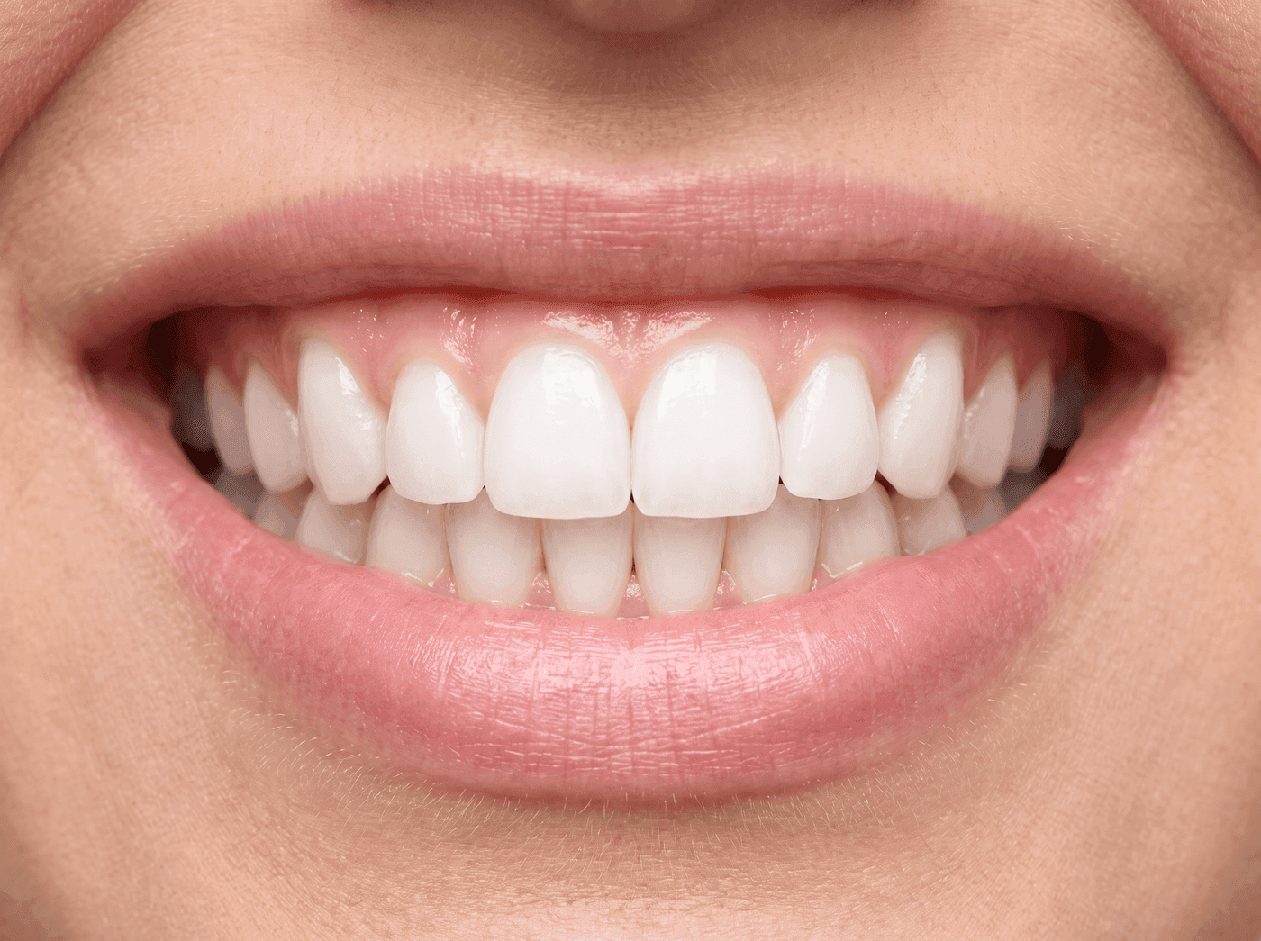 Sonrisa después del tratamiento